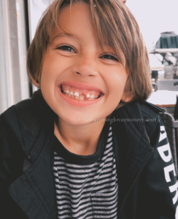 How to Care for and Preserve Your Child's Loose Tooth.